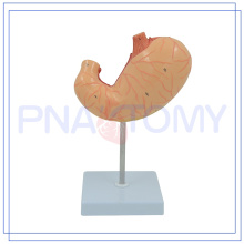 PNT-0459 modelo de estômago 3D